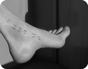 How Tibialis Posterior Works: Lengthening