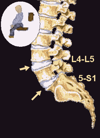 The Chair Sitting Lumbar Spine