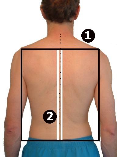 Pilates Box shortended on the right side